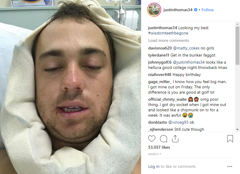 justin thomas wisdom teeth instagram - Recent Celebrities to have Wisdom Teeth Removal