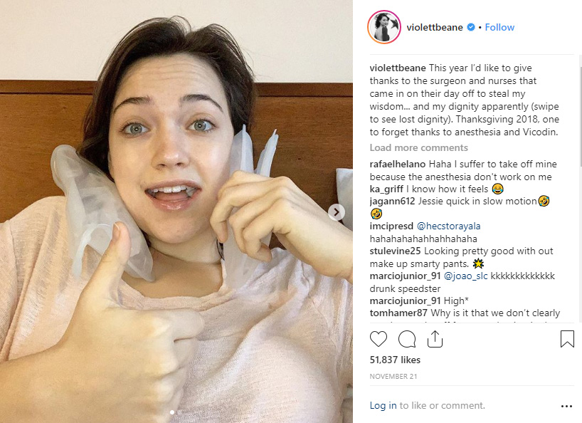 violett beane wisdom teeth removal - Recent Celebrities to have Wisdom Teeth Removal