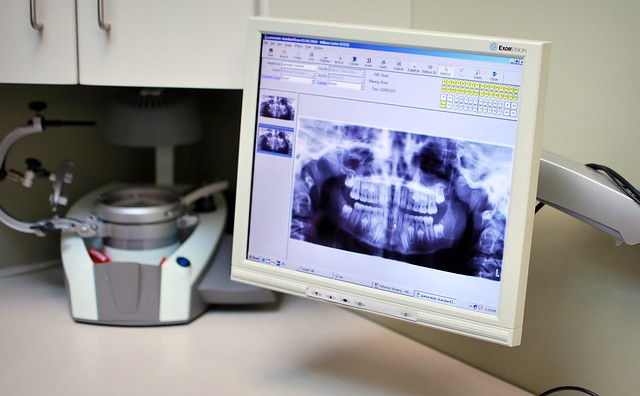 dental xray screen - Differences Among Classifying Wisdom Teeth using Panoramic X-rays and Cone-Beam Computed Tomography