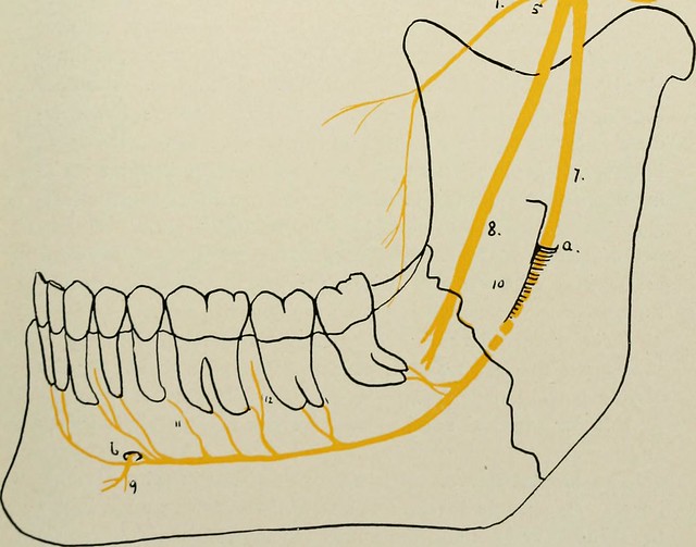 lingual nerve sketch mouth - Preventing Lingual Nerve Damage After Wisdom Teeth Extraction