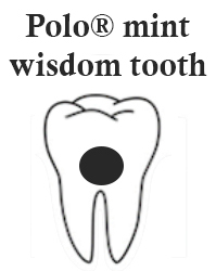 polo mint wisdom tooth teeth - What is the Polo Mint Wisdom Tooth and How to Treat It