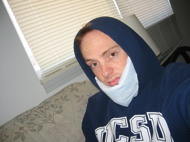 wisdom teeth ice compress cold - Cold Therapy after Wisdom Teeth Surgery Meta Analysis