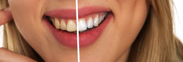 teeth whitening woman smile - Reasons Why You Should Look Into Cosmetic Dentistry