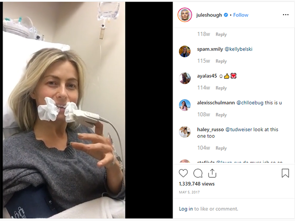 julianne hough wisdom teeth post op - Celebrities who have had Wisdom Teeth Extracted