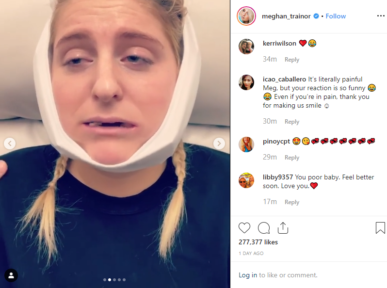 meghan trainor wisdom teeth removal - Meghan Trainor Has All Four Wisdom Teeth Removed