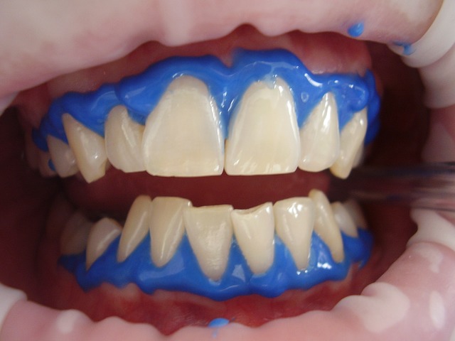 laser teeth whitening - Cosmetic Dentistry in the Era of COVID-19