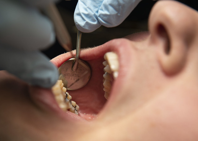 dental mouth exam - Behavioral Interventions for Periodontal Disease