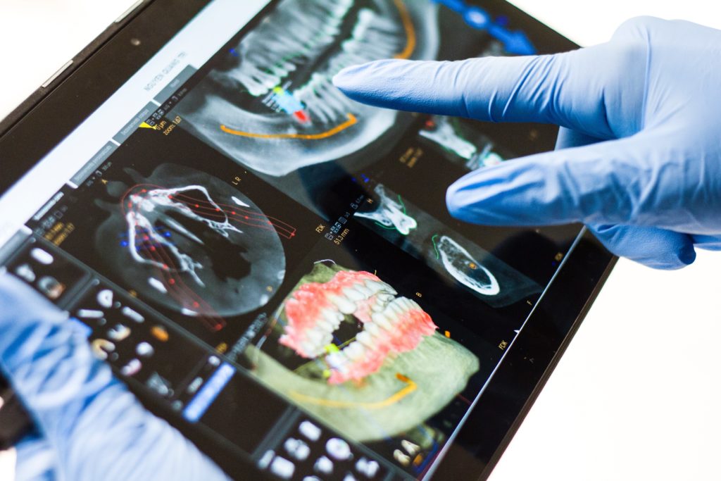 dental x ray 1024x683 - Updated Guidance on Patient Shielding During Dental x-rays